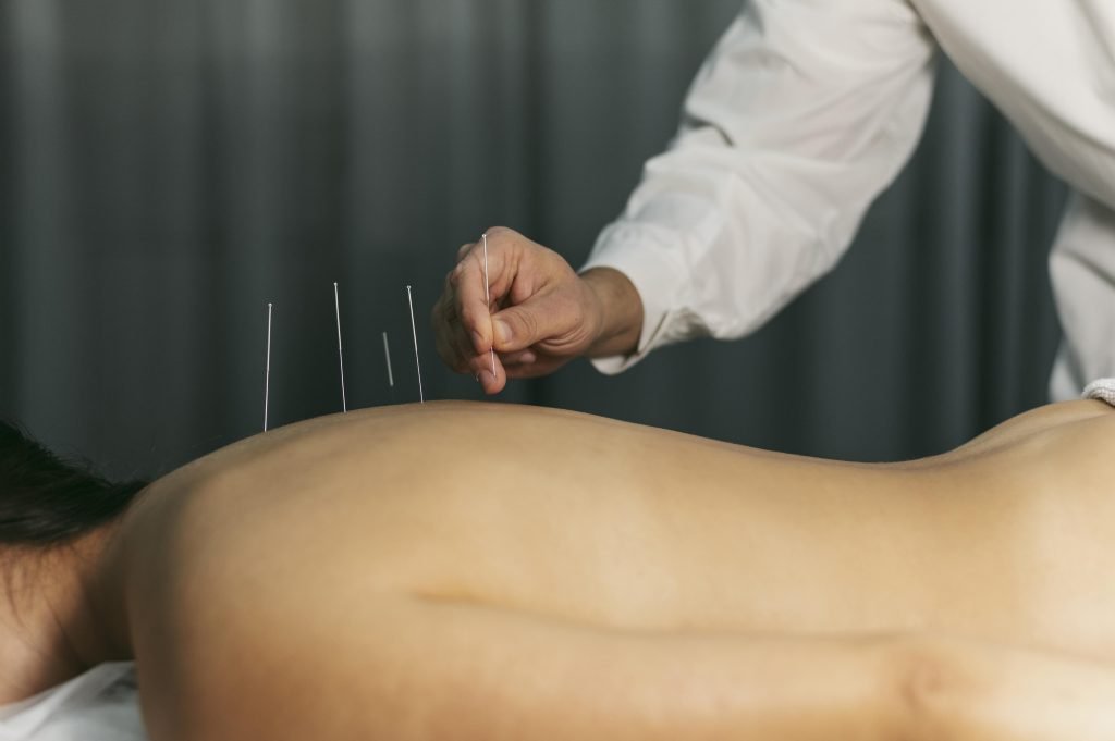 Acupuncturist in Gouda